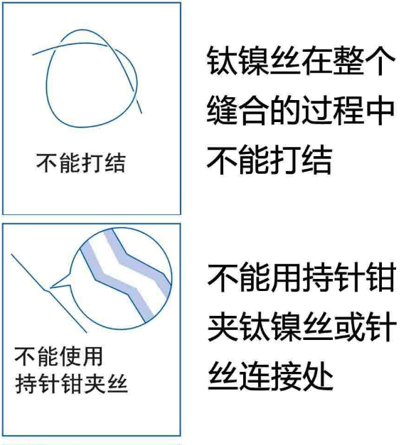 【官方网站机械】钛镍记忆合金组织吻合器使用注意事项